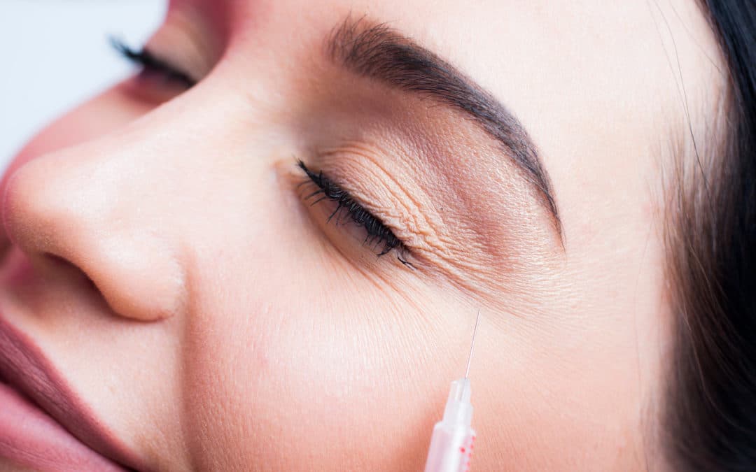 When Is The Best Age For Botox®?